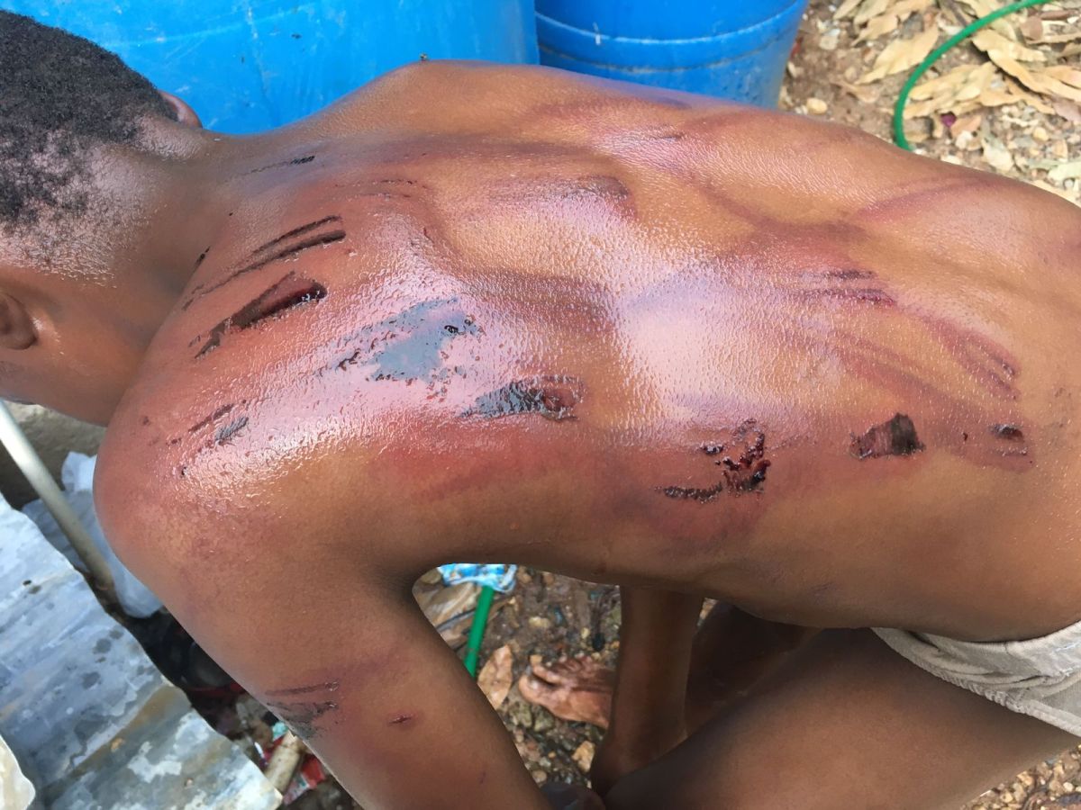 PN busca padre agredió severamente hijo menor en&nbsp;Montecristi